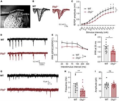 A Deficiency of the Psychiatric Risk Gene DLG2/PSD-93 Causes Excitatory Synaptic Deficits in the Dorsolateral Striatum